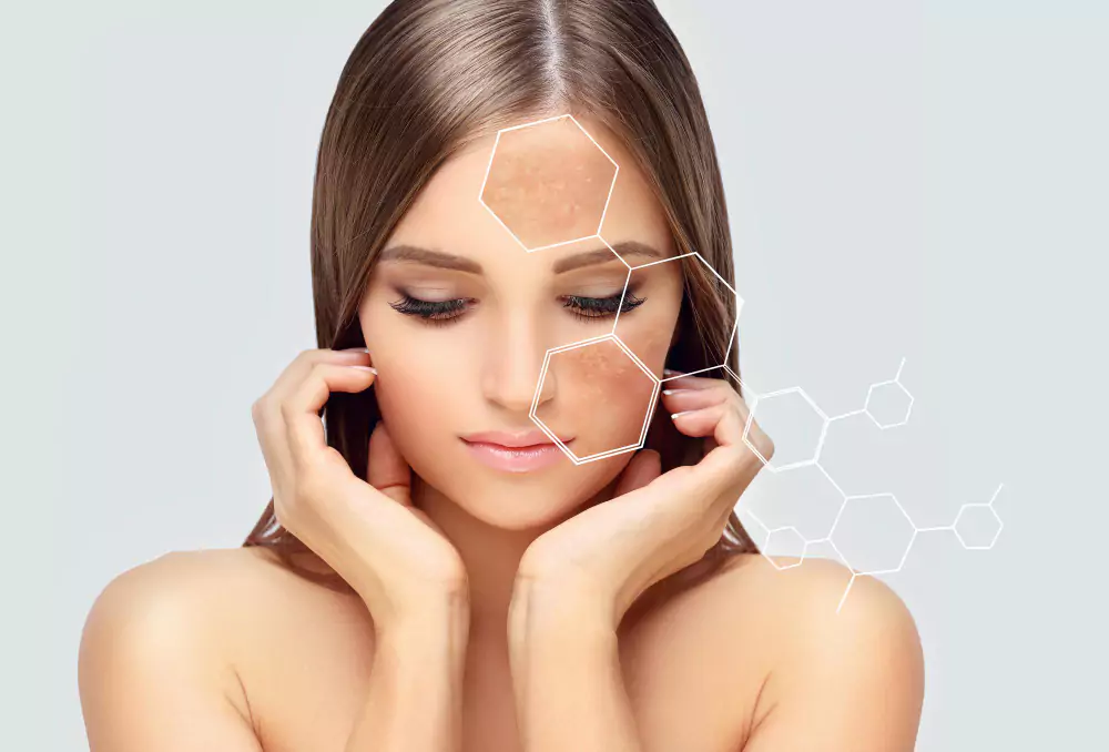 Hyperpigmentation Treatment